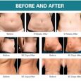 Advanced Cryo Machine: Sculpting & Fat Reduction