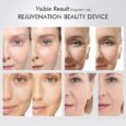 6-in-1 LED, EMS & Skincare Absorption
