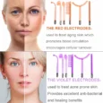 6-in-1 High Frequency Wand: Neon Electrotherapy device for Acne, Skin & Hair